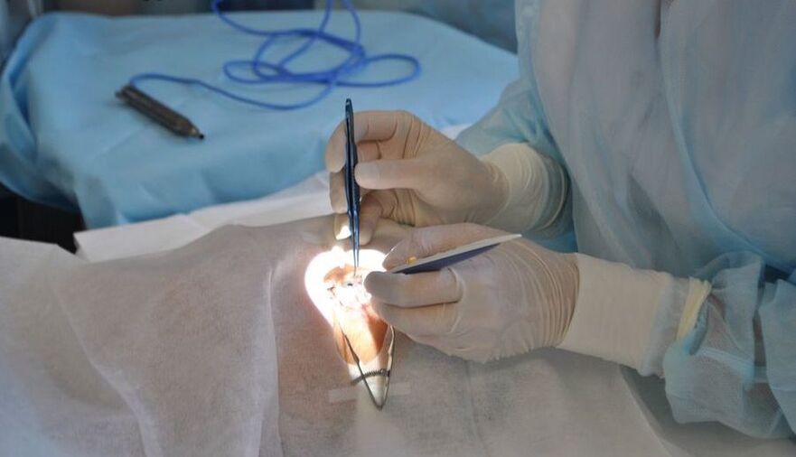 Eye surgery to restore vision
