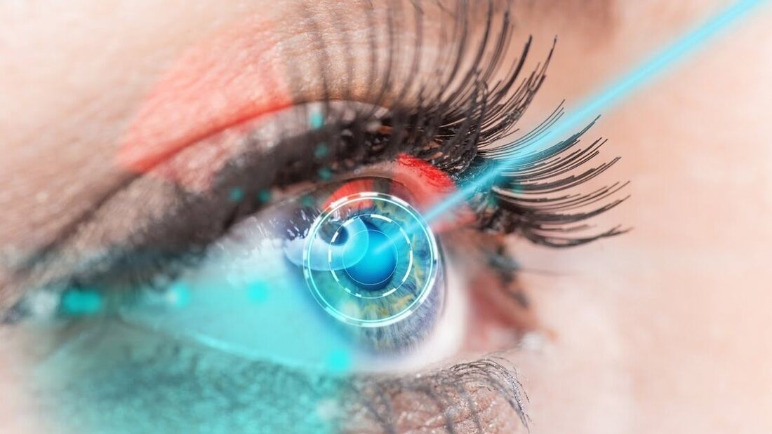 Restoration of vision using laser correction